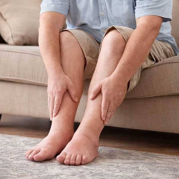 علائم اولیه واریس پا؛ نشانه‌هایی که نباید نادیده گرفته شوند