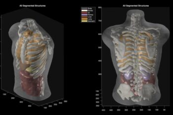 اسکن کامل بدن بدون MRI؛ میدجرنی از پروژه جاه‌طلبانه «Midjourney Medical» رونمایی کرد